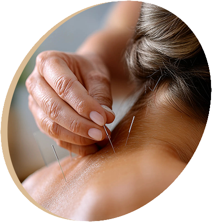 Osteopunktur